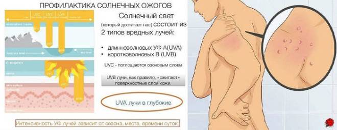 Что делать если после загара чешется кожа в домашних условиях