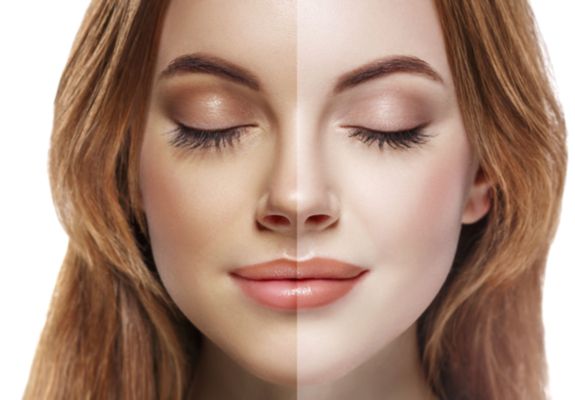 Что можно использовать после загара в солярии