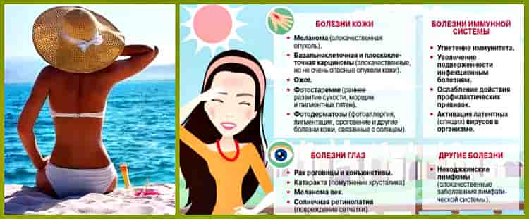 Что такое загар с медицинской точки зрения